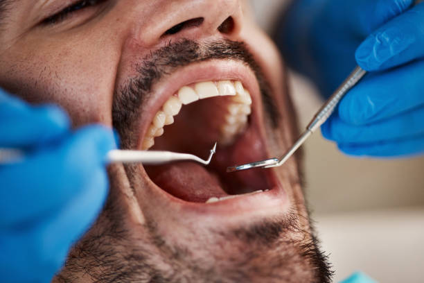 Professional Holistic Dental Care Services in Pacific, WA